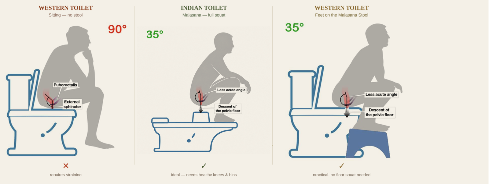 Three postures compared — western toilet sitting at 90 degrees, Indian toilet full Malasana squat at 35 degrees, and western toilet with feet on the Malasana stool at 35 degrees